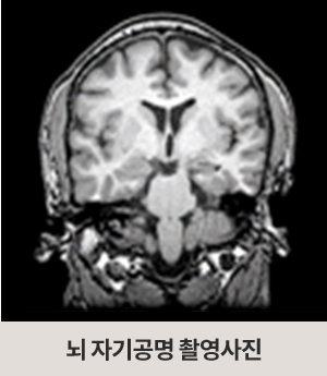 뇌 자기공명 촬영사진